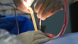 National Heart Centre