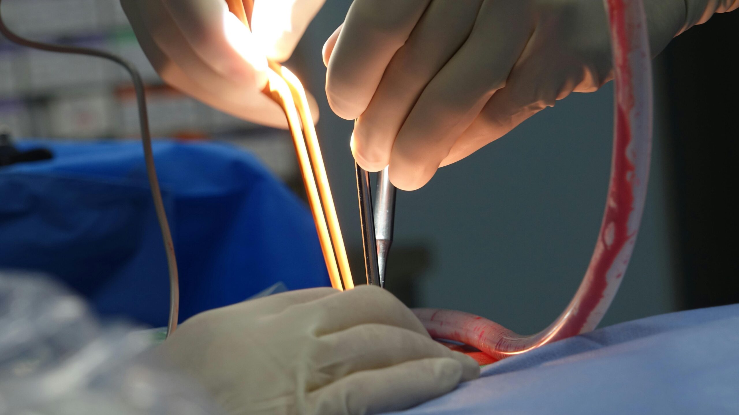 The Crazy Truth About National Heart Centre Campaigns